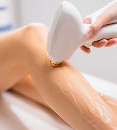 Epilation définitive lumière pulsée